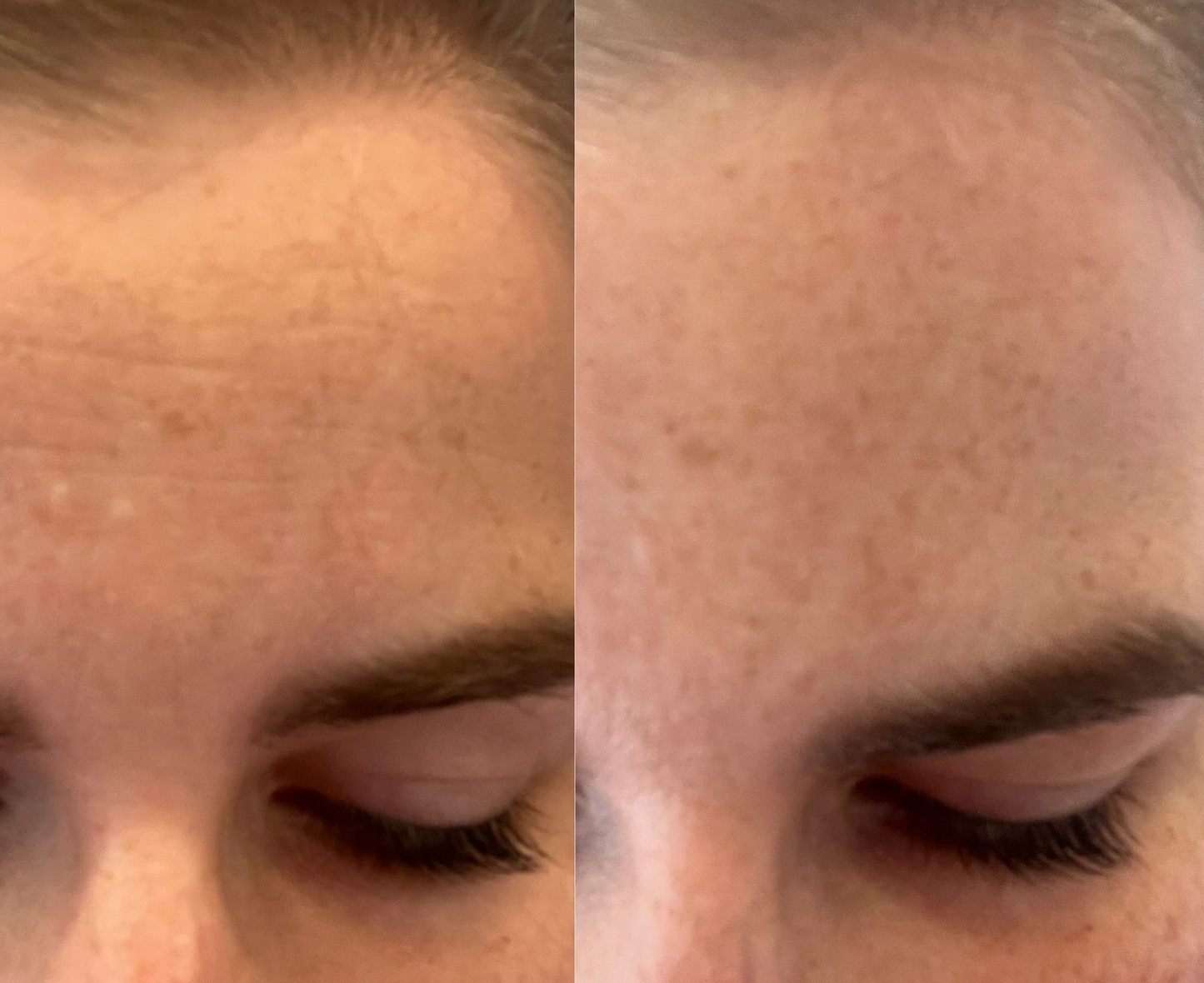 Emmagen Age-less Facial Mask