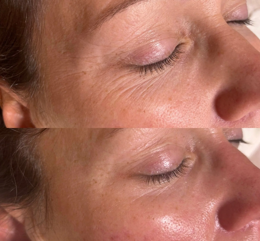 Emmagen Firm & Glow Hydrogel Eye Patches