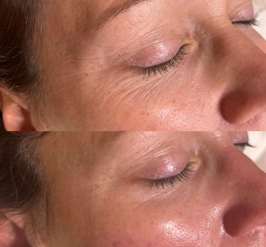 Emmagen Firm & Glow Hydrogel Eye Patches